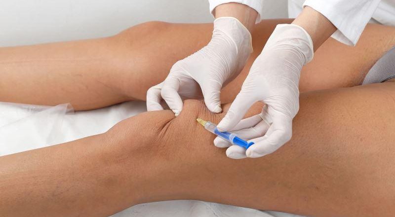 Global Knee Hyaluronic Acid Injections Market: Analysis, Trends, and Forecast