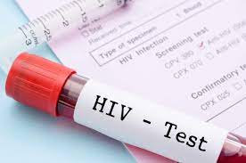 Preventing the Spread of HIV in Jacksonville: Testing as a Key Strategy