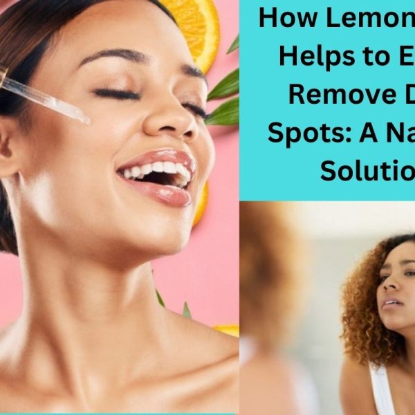 How Lemon Juice Helps to Easily Remove Dark Spots: A Natural Solution