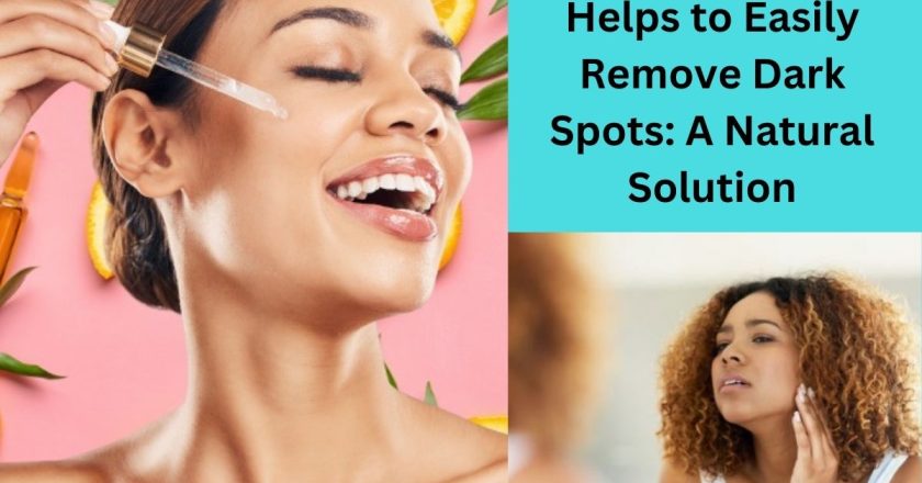 How Lemon Juice Helps to Easily Remove Dark Spots: A Natural Solution