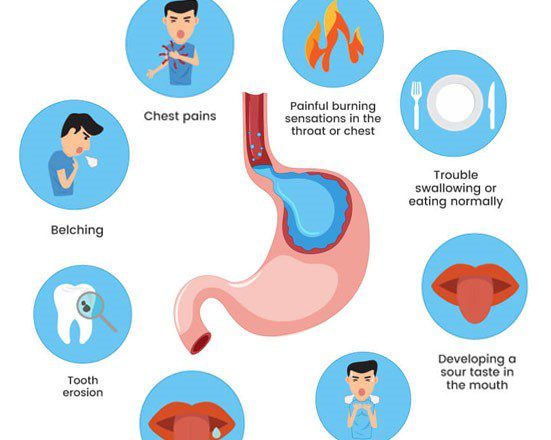 How to deal with acid reflux and indigestion?